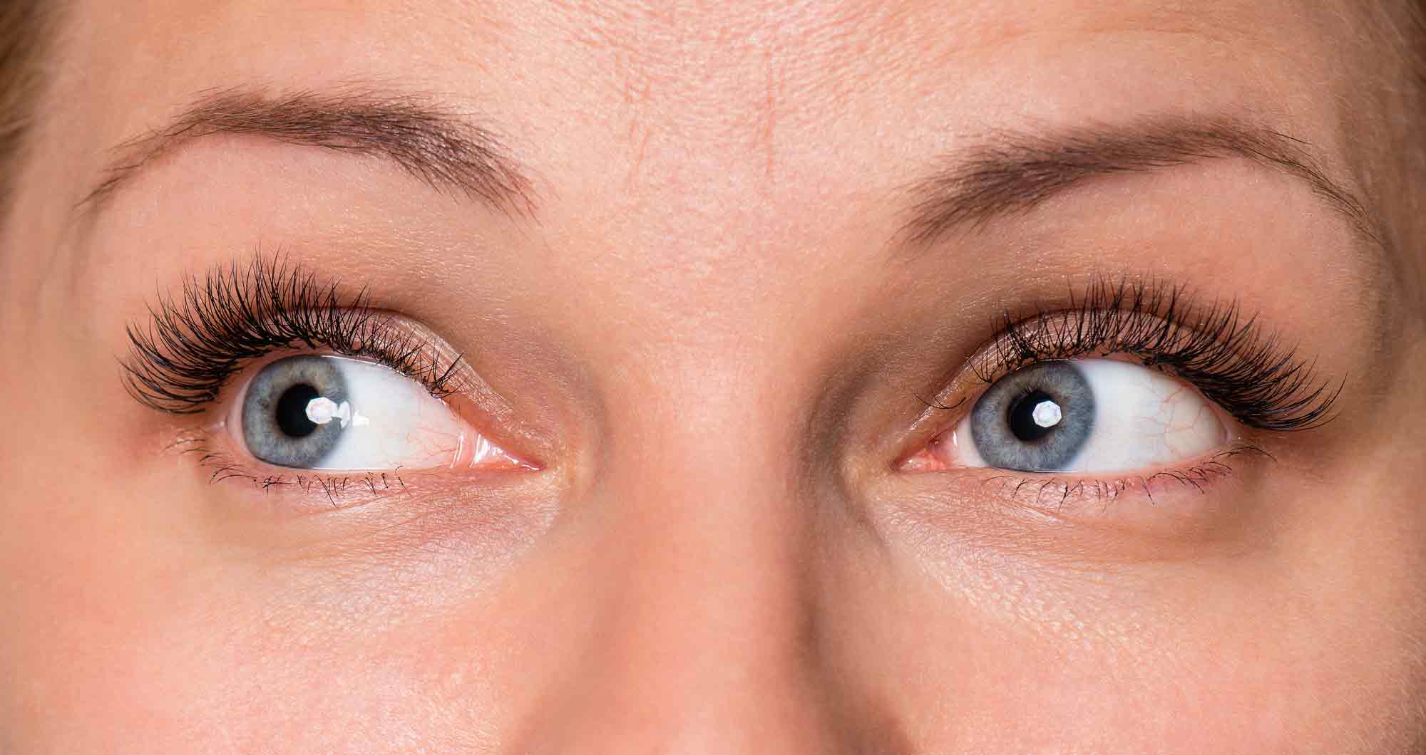 Could It Be Your Eyes? Recognizing Vertical Heterophoria