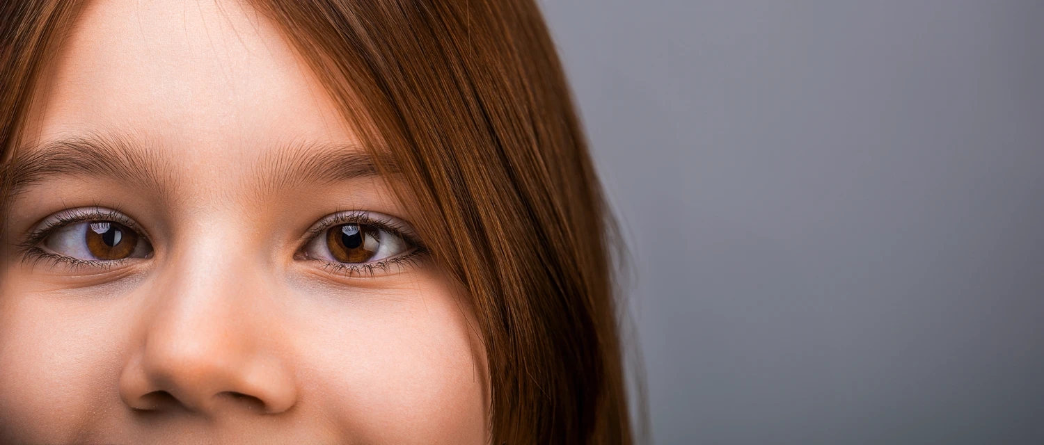 A child with a slight case of strabismus in one eye, possibly causing intermittent double vision